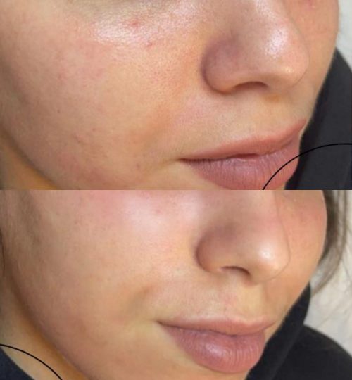 b70ebceb-86d2-42f3-85ce-8da0ce0eb34c